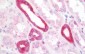PRKCB / PKC-Beta Antibody (aa621-670)